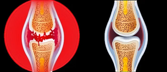 Osteon : sastav samo prirodnih sastojaka.