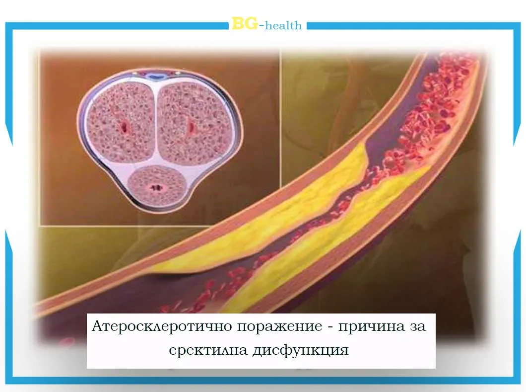 Testoy : sastav samo prirodnih sastojaka.
